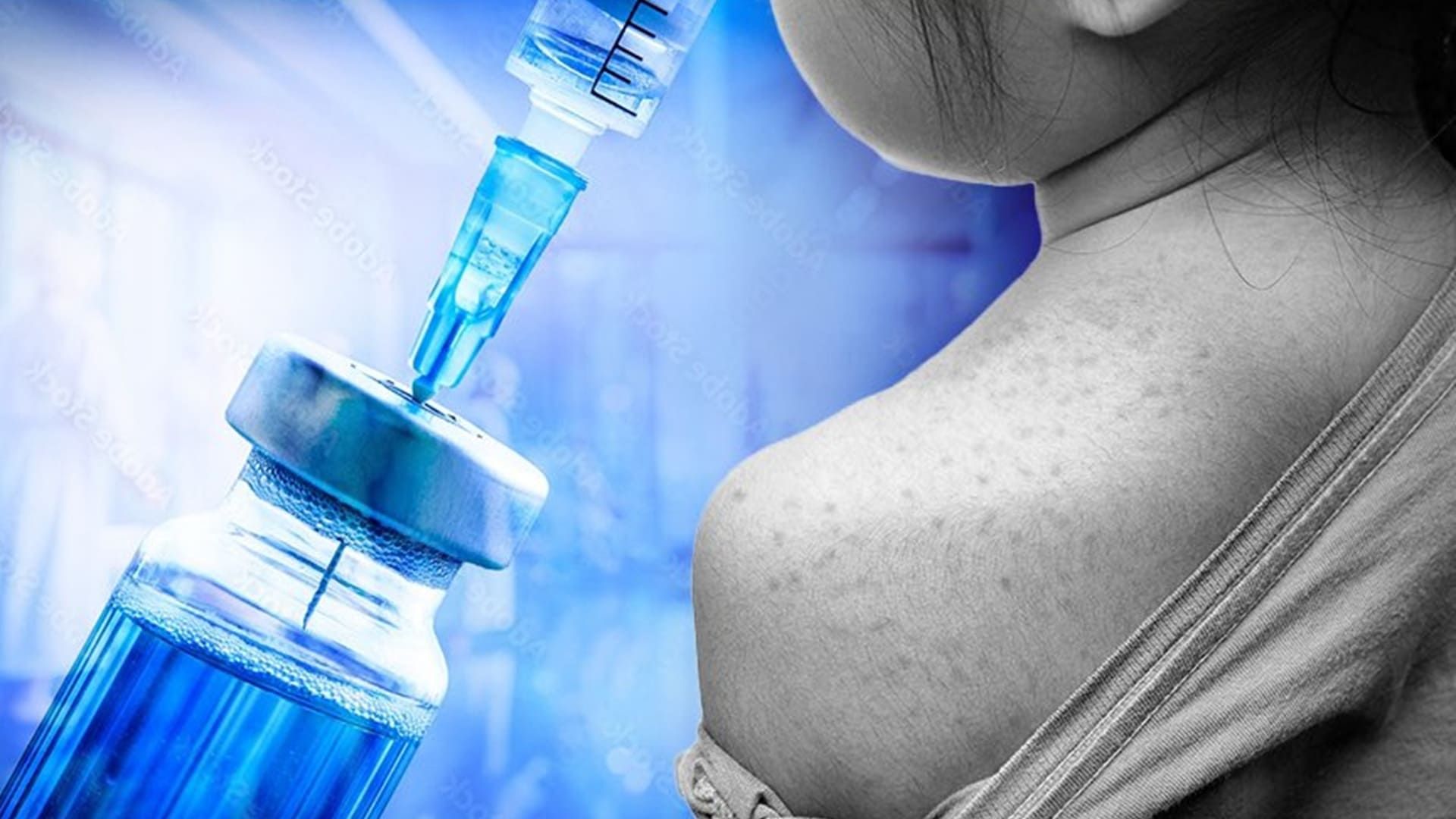 Oaxaca confirma un caso de sarampión importado por niña estadunidense